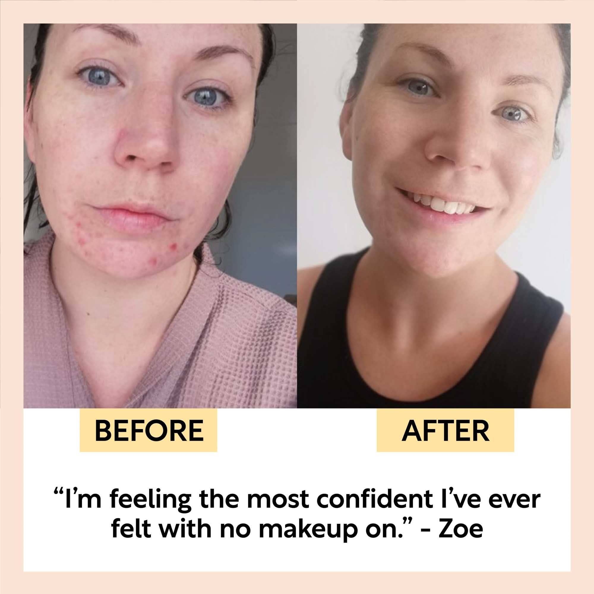 SPF 25 Minerale Zonnebrandcrème Rifveilig Veganistisch Milieuvriendelijk Crème